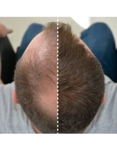 FIBRAS CAPILARES KERATINA... 2